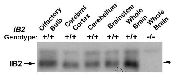 Anti-JIP-2/IB-2 Antibody