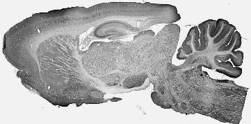 Anti-JIP-2/IB-2 Antibody - Image 2