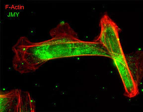 Anti-JMY (C-terminal region) Antibody - Image 2
