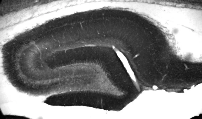 Anti-KCC2 Antibody - Image 3