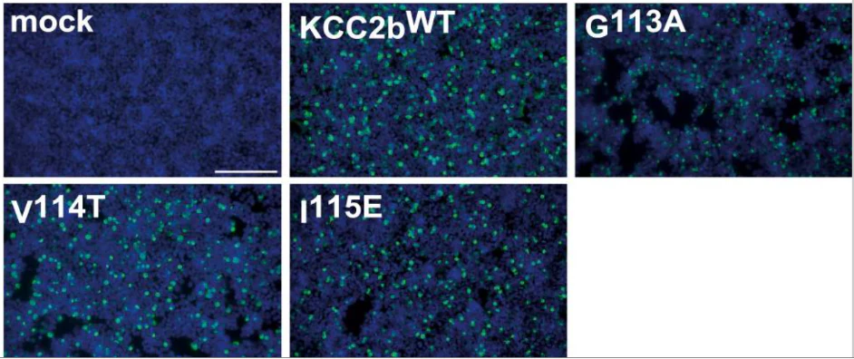 Anti-KCC2 Antibody - Image 4