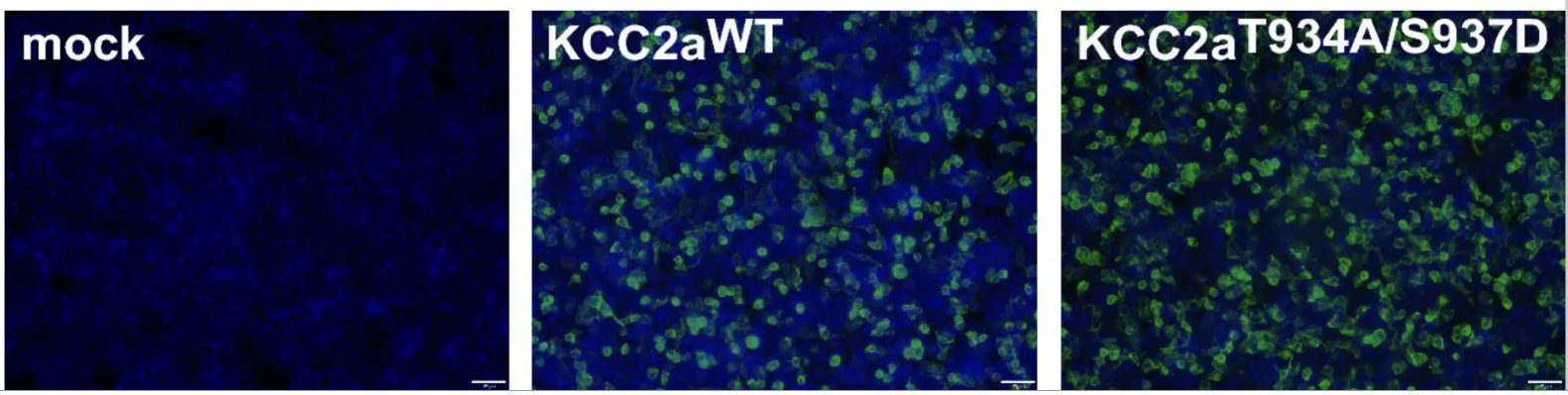 Anti-KCC2 Antibody - Image 5