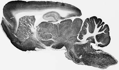 Anti-KCC2 Antibody - Image 2