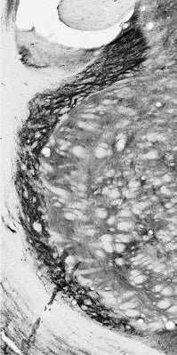 Anti-KChIP1 K+ Channel Antibody - Image 2