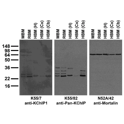 Anti-KChIP1 K+ Channel Antibody - Image 3