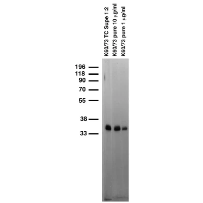 Anti-KChIP2b K+ Channel Antibody - Image 2