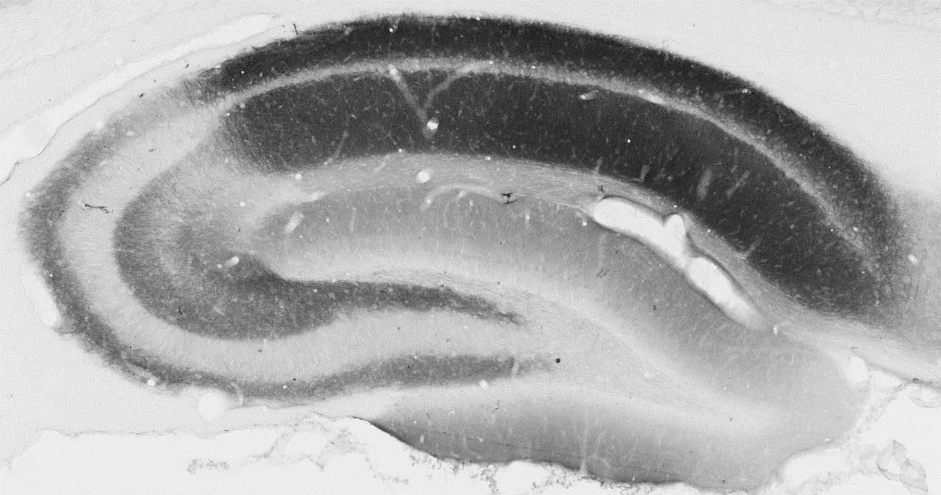 Anti-KChIP4 K+ channel Antibody