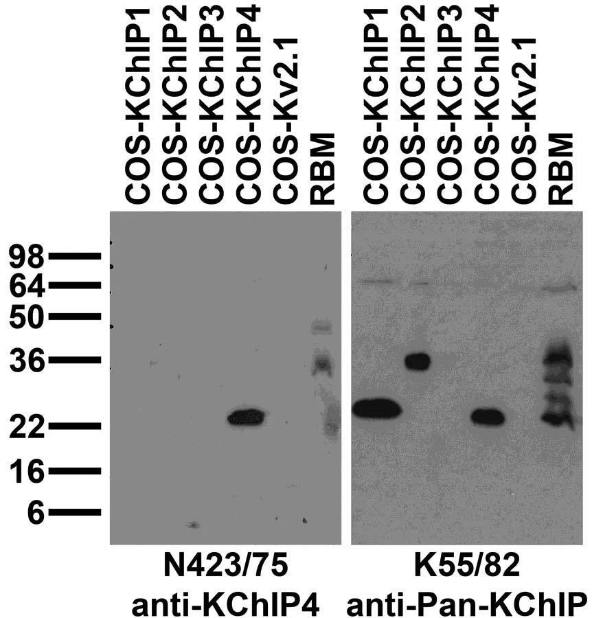 Anti-KChIP4 K+ channel Antibody - Image 2