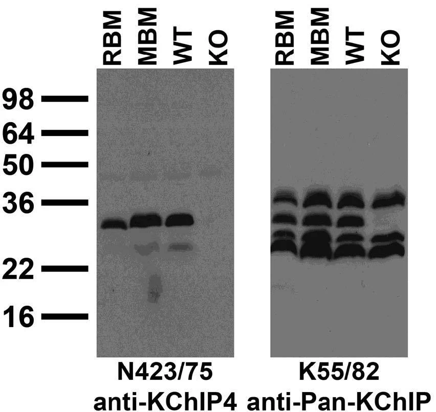 Anti-KChIP4 K+ channel Antibody - Image 3