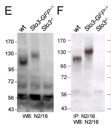 Anti-KCNU1/Slo3 pH-Sensitive Maxi-K+ Channel Antibody