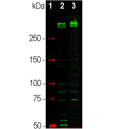 Anti-Ki-67 Antibody - Image 2
