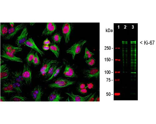 Anti-Ki-67 Antibody