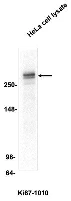 Anti-Ki-67 Antibody - Image 2