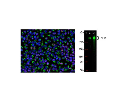 Anti-Ki-67 Antibody