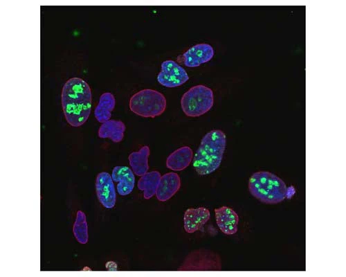 Anti-Ki-67 Antibody - Image 2
