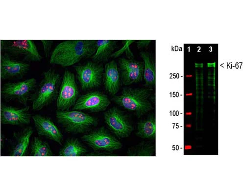 Anti-Ki-67 Antibody