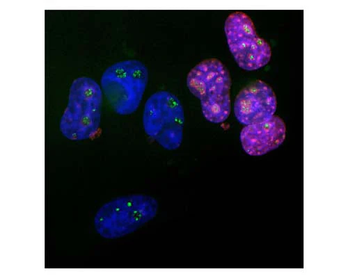 Anti-Ki-67 Antibody - Image 2