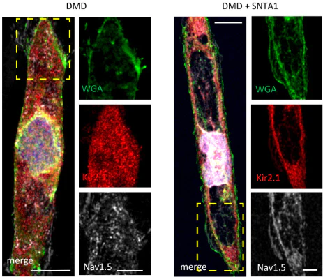 Anti-Kir2.1 K+ Channel Antibody - Image 3