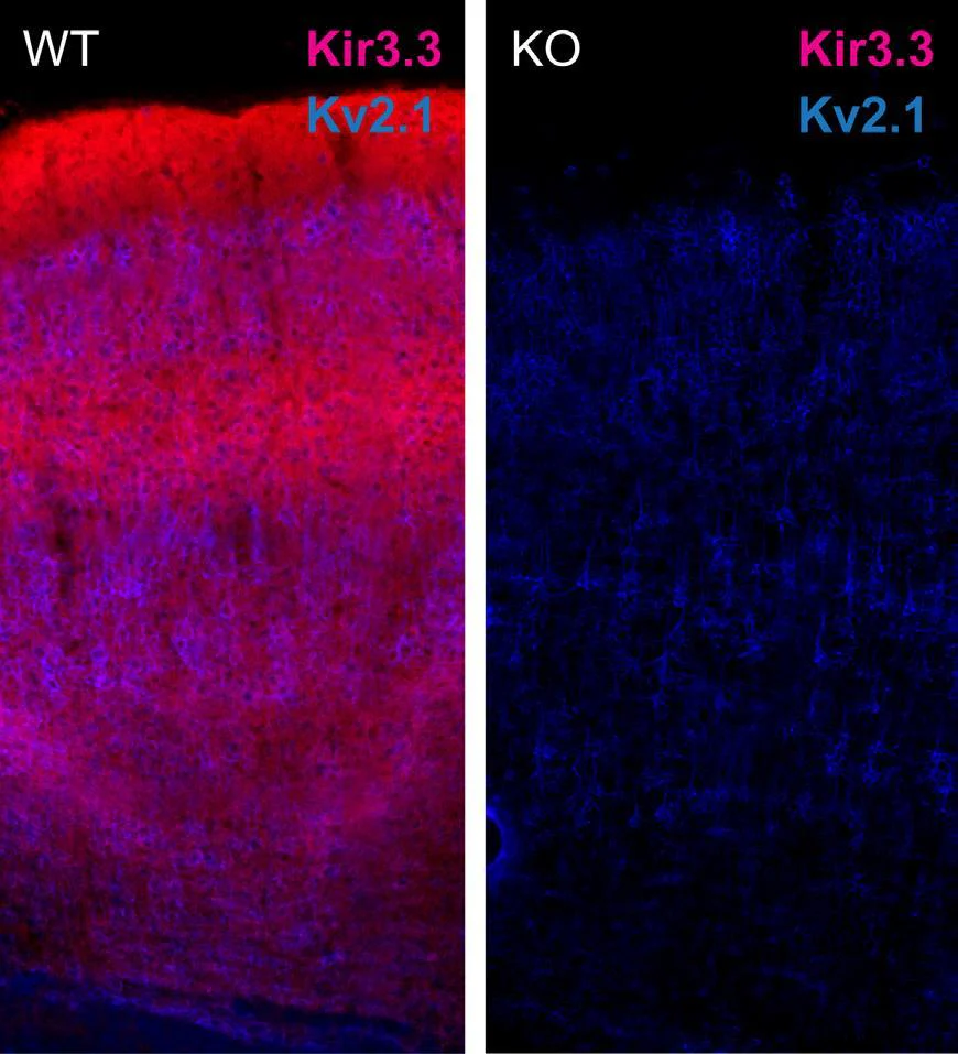 Anti-Kir3.3 Antibody