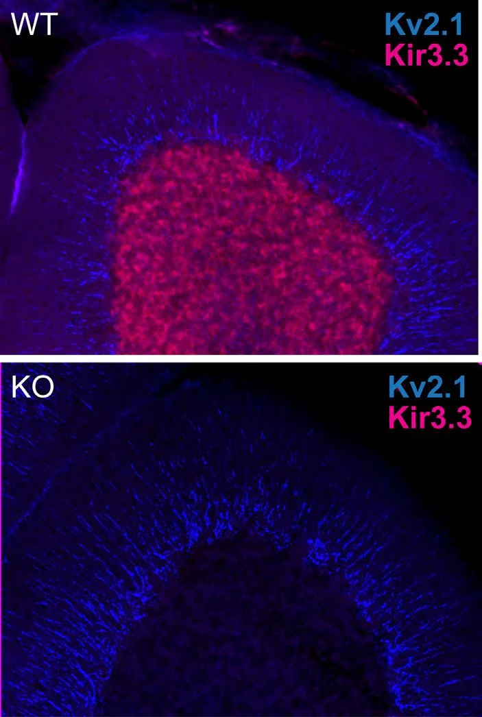 Anti-Kir3.3 Antibody - Image 2