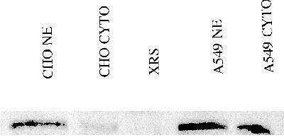 Anti-Ku80 Antibody