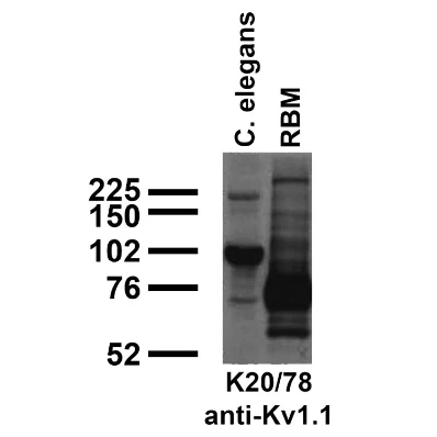 Anti-Kv1.1 K+ Channel Antibody - Image 3