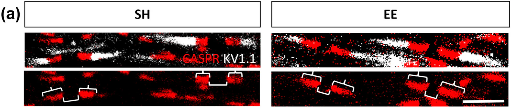 Anti-Kv1.1 K+ Channel (External) Antibody - Image 3