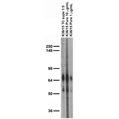 Anti-Kv1.1 K+ Channel (External) Antibody - Image 4