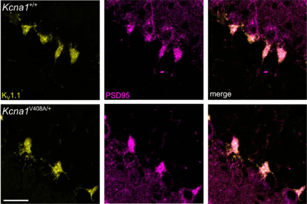 Anti-Kv1.1 K+ Channel (External) Antibody - Image 7