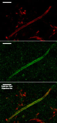 Anti-Kv1.1 K+ Channel (External) Antibody - Image 8