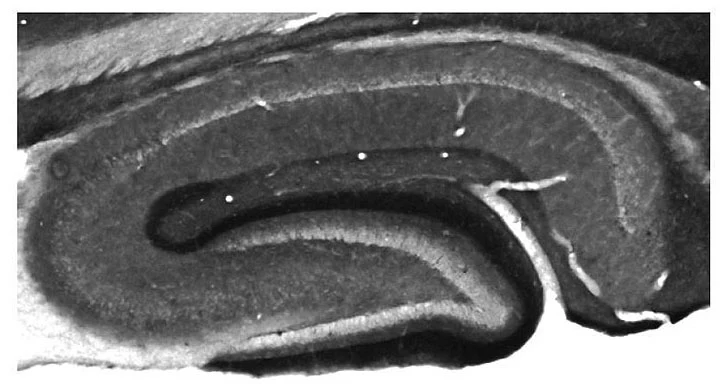 Anti-Kv1.2 K+ Channel Antibody - Image 5