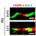 Anti-Kv1.2 K+ Channel Antibody - Image 8