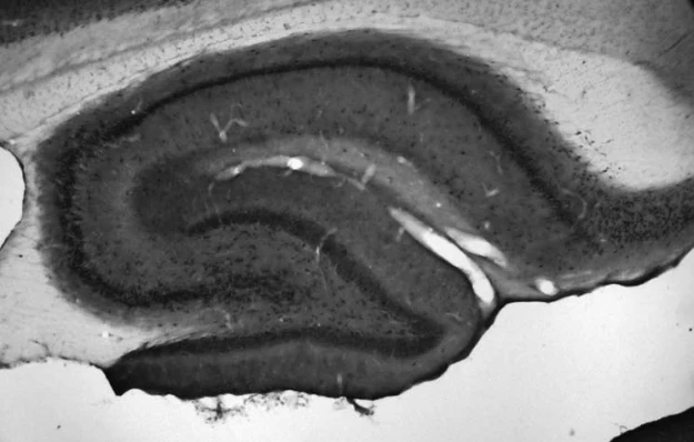 Anti-Kv1.3 K+ Channel Antibody - Image 4