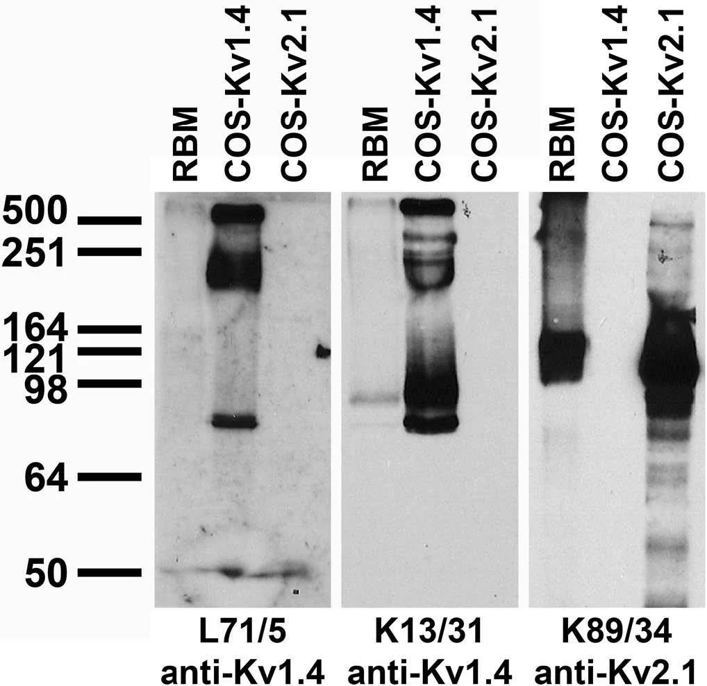 Anti-Kv1.4 Potassium Channel (Extracellular) Antibody