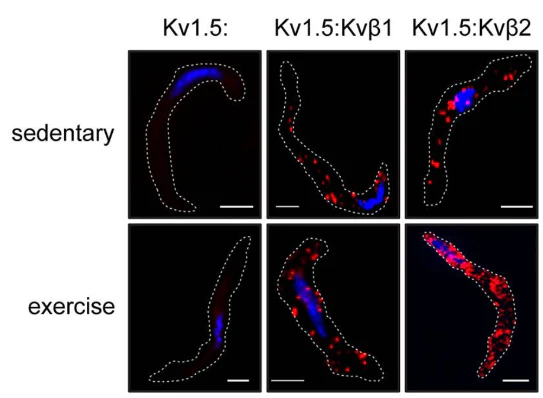 Anti-Kv1.5 K+ Channel Antibody - Image 4