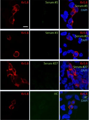 Anti-Kv1.6 K+ Channel Antibody - Image 3