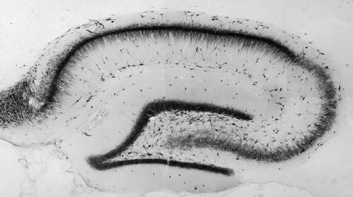 Anti-Kv2.1 K+ Channel Antibody - Image 2