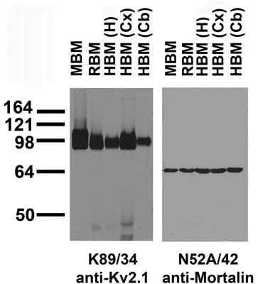 Anti-Kv2.1 K+ Channel Antibody - Image 5