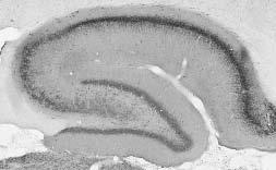 Anti-Kv2.1 Potassium Channel Subunit Antibody
