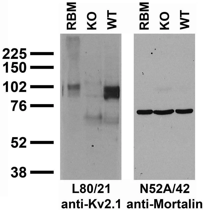 Anti-Kv2.1 Potassium Channel Subunit Antibody - Image 3
