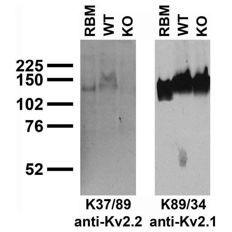 Anti-Kv2.2 K+ Channel Antibody - Image 3