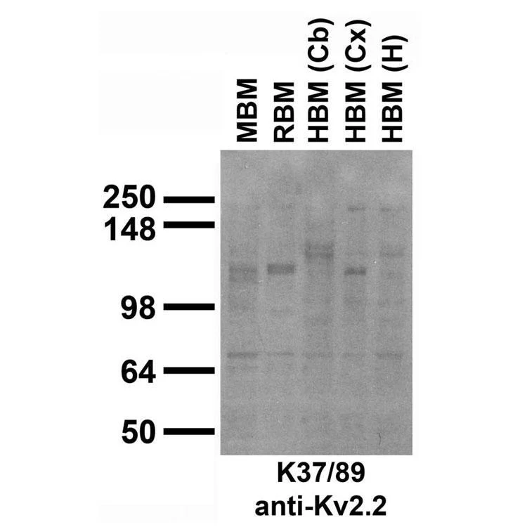 Anti-Kv2.2 K+ Channel Antibody - Image 4