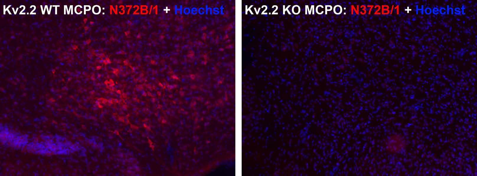 Anti-Kv2.2 Potassium Channel Antibody