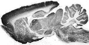 Anti-Kv2.2 Potassium Channel Antibody - Image 2