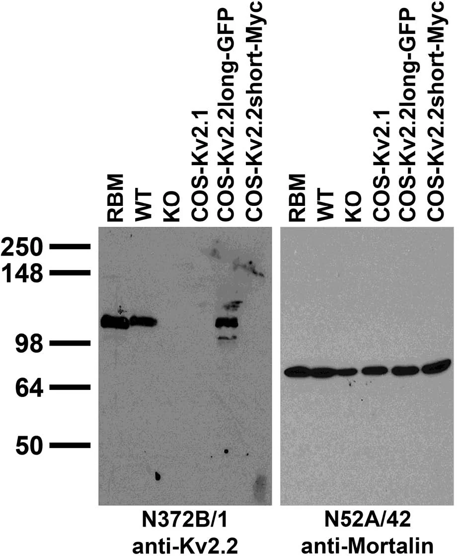 Anti-Kv2.2 Potassium Channel Antibody - Image 3