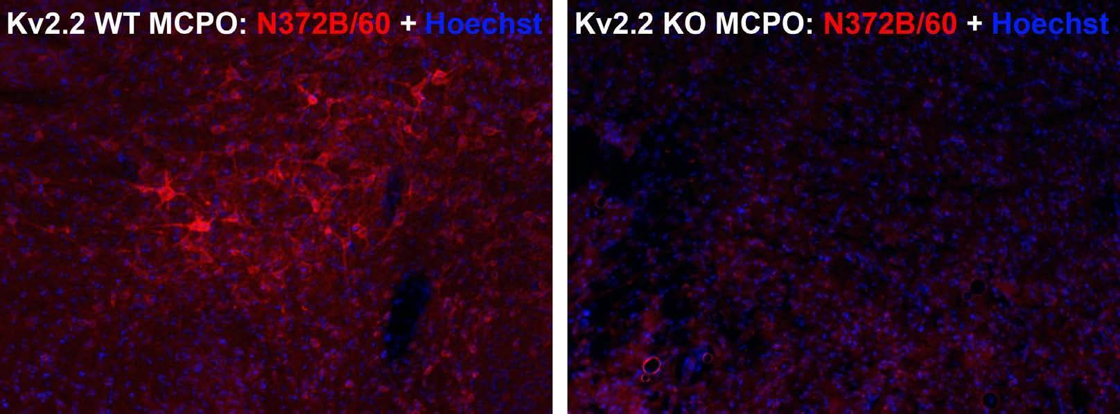 Anti-Kv2.2 Potassium Channel Antibody