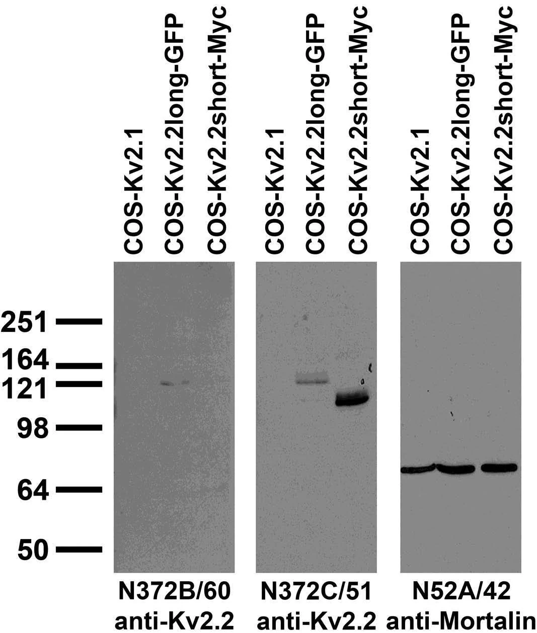 Anti-Kv2.2 Potassium Channel Antibody - Image 2