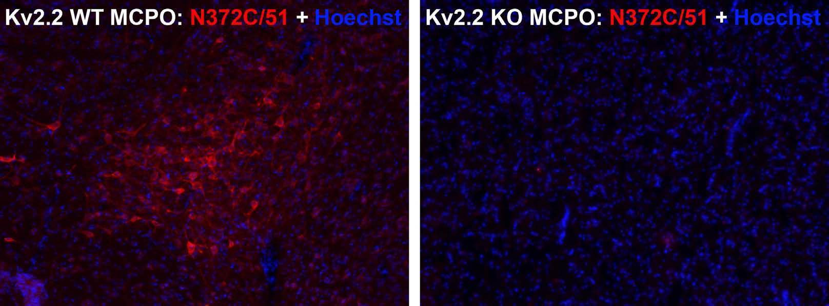 Anti-Kv2.2 Potassium Channel Antibody