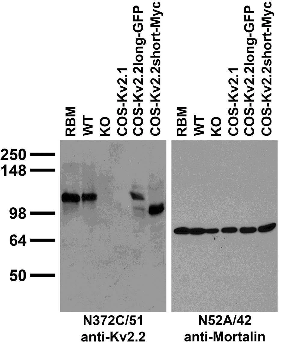 Anti-Kv2.2 Potassium Channel Antibody - Image 3