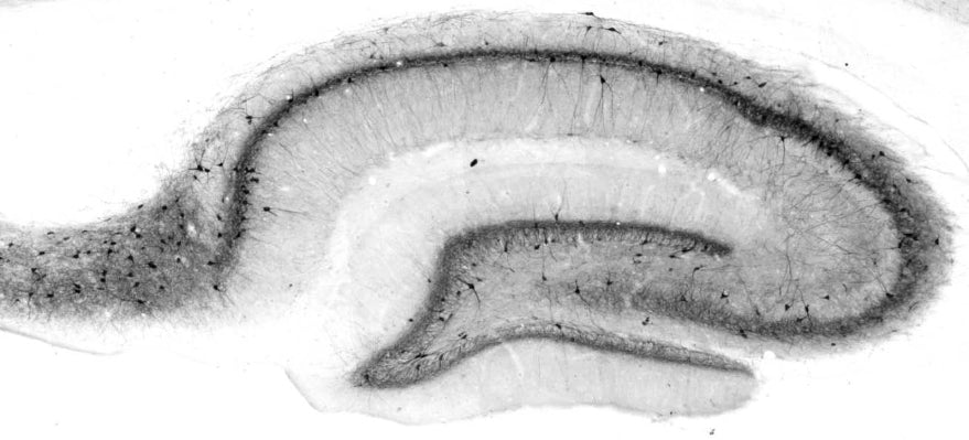 Anti-Kv3.1B K+ Channel Antibody